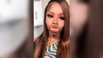 What Was Wrong With Her Lips?