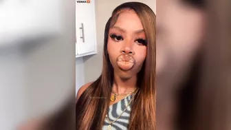 What Was Wrong With Her Lips?