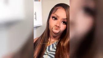 What Was Wrong With Her Lips?