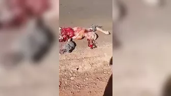 A Collection Of Several Horrific Incidents In Which Bodies Were Torn Apart.