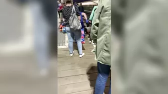 A Man Lost His Leg After Falling On Subway Tracks. Russia, Male