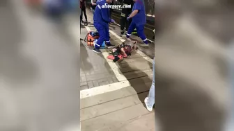 A Man Lost His Leg After Falling On Subway Tracks. Russia, Male