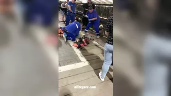 A Man Lost His Leg After Falling On Subway Tracks. Russia, Male