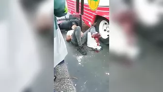 A Motorcyclist Who Suffered A Leg Injury In An Accident Received An S-point