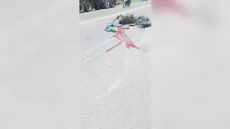 Biker Suffers Fractured Skull After Collision With Truck