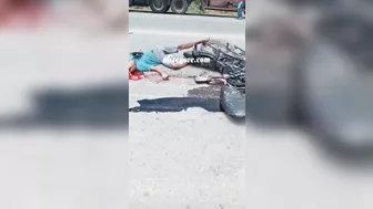Biker Suffers Fractured Skull After Collision With Truck