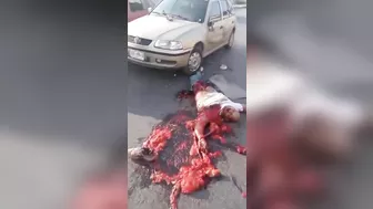 Man Turned Into Minced Meat After Accident