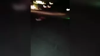 As A Result Of The Accident, The Man Lost A Leg And An Arm.