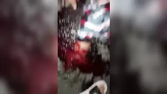 As A Result Of The Accident, The Man Lost A Leg And An Arm.