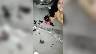 As A Result Of The Accident, The Man Lost A Leg And An Arm.