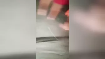 As A Result Of The Accident, The Man Lost A Leg And An Arm.
