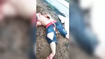 As A Result Of The Accident, The Man's Body Was Completely Mauled.