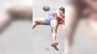The Accident Caused The Woman's Stomach To Rupture.