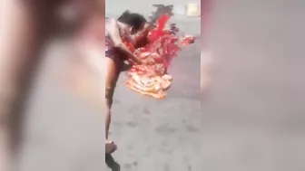 The Accident Caused The Woman's Stomach To Rupture.