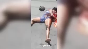 The Accident Caused The Woman's Stomach To Rupture.