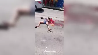 The Accident Caused The Woman's Stomach To Rupture.
