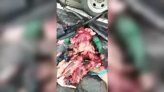 A Brutal Bloody Massacre After A Horrific Accident...complete Dismemberment.