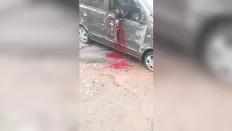Car Accident Ended With A Broken Hand
