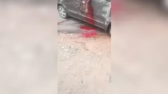 Car Accident Ended With A Broken Hand