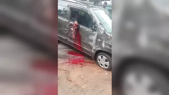 Car Accident Ended With A Broken Hand
