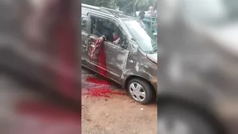 Car Accident Ended With A Broken Hand