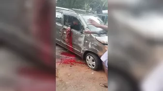 Car Accident Ended With A Broken Hand