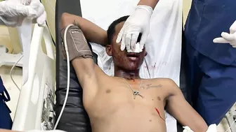 Policeman Accidentally Shoots His Partner During Fight With Criminal
