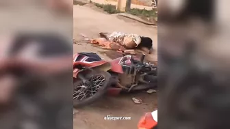 The Horrible Consequences Of A Motorcycle Accident