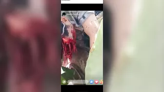 Accident Between Trucks Causes Face Explosion