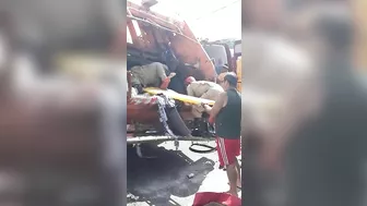 Garbage Truck Worker Loses Both Legs