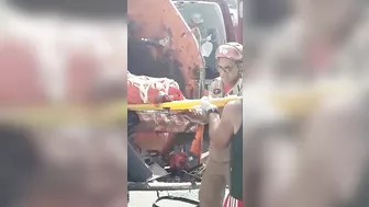 Garbage Truck Worker Loses Both Legs