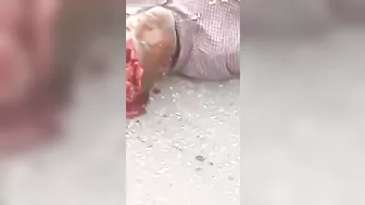 Head Exploded After Collision With Truck