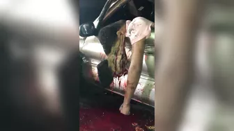 Head Smashed In Brutal Accident