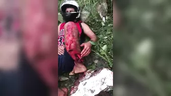 At The Time Of The Accident, The Motorcyclist Kept His Helmet But Not