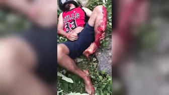 At The Time Of The Accident, The Motorcyclist Kept His Helmet But Not