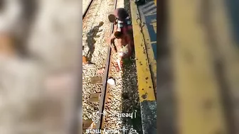 Train Accident Destroyed Both Legs