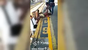 Train Accident Destroyed Both Legs