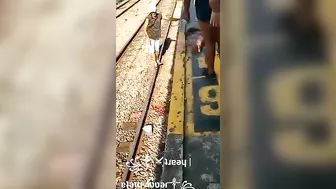 Train Accident Destroyed Both Legs