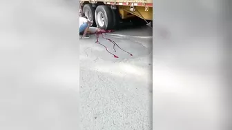 Man's Lower Body Crushed By Huge Trailer - Uncensored