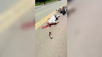 Man's Head Accidentally Blown Off