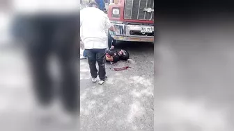 Motorcyclist Loses Left Arm After Being Hit By Truck