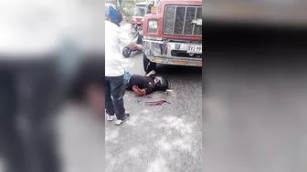 Motorcyclist Loses Left Arm After Being Hit By Truck