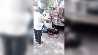 Motorcyclist Loses Left Arm After Being Hit By Truck