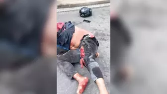 Malaysian Motorcyclist Suffers Serious Accident