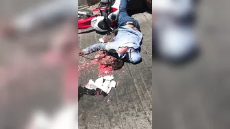 Motorcyclist's Head Crushed By Helmet