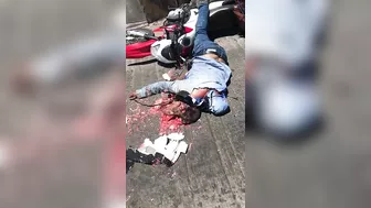 Motorcyclist's Head Crushed By Helmet