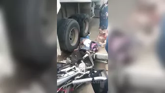 Motorcyclist's Legs Crushed By Truck Wheel