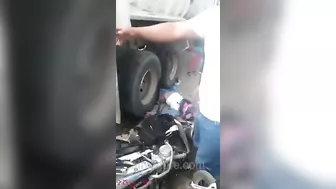 Motorcyclist's Legs Crushed By Truck Wheel