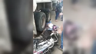 Motorcyclist's Legs Crushed By Truck Wheel