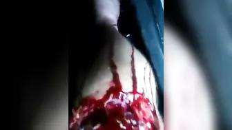 Tragic! Man Injured His Knee In Accident